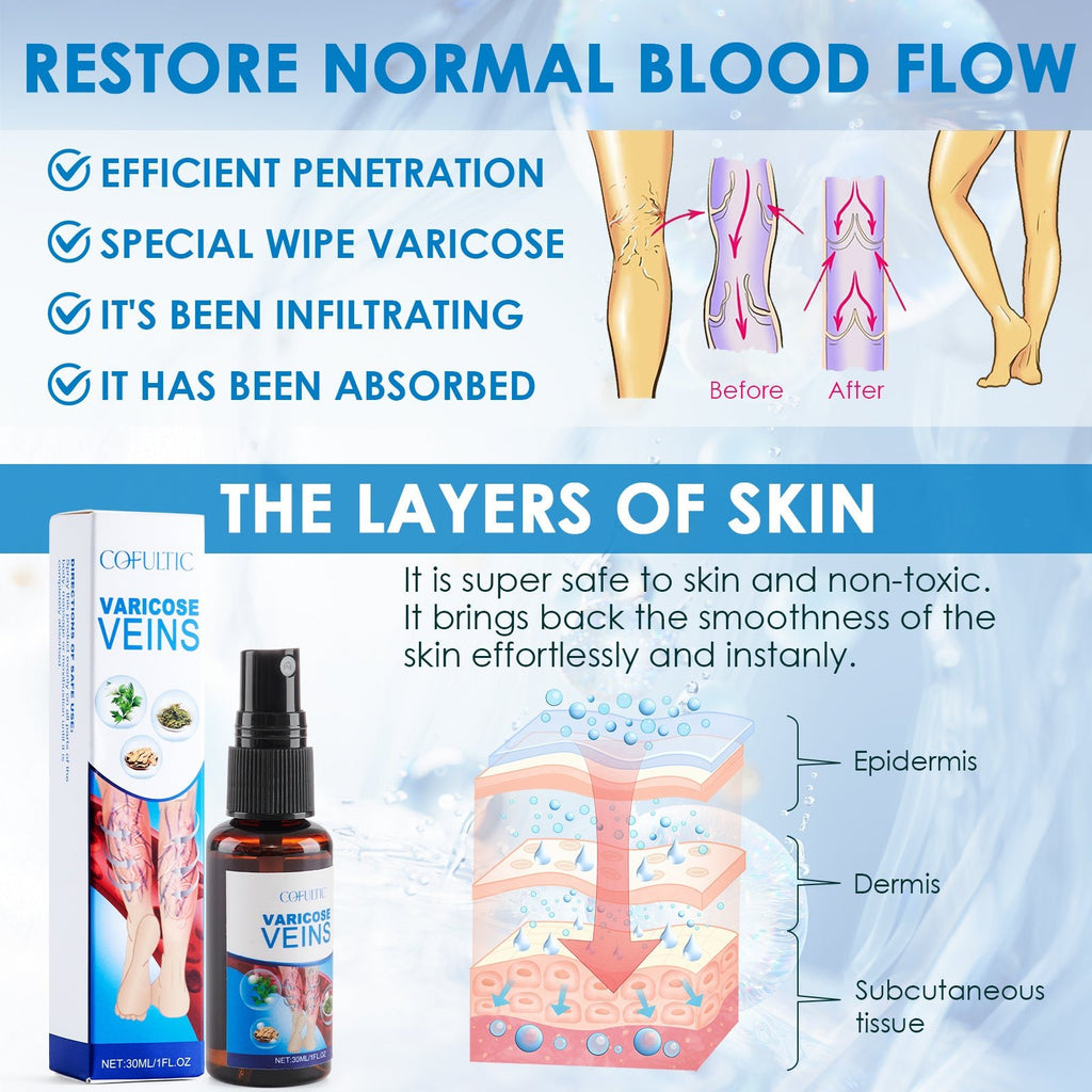 30ml Varicose Vein Spray Multi - Purpose Knee And Leg Care Spray Promote Blood Circulation - Beautybuzz