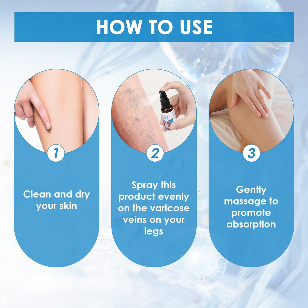 30ml Varicose Vein Spray Multi - Purpose Knee And Leg Care Spray Promote Blood Circulation - Beautybuzz