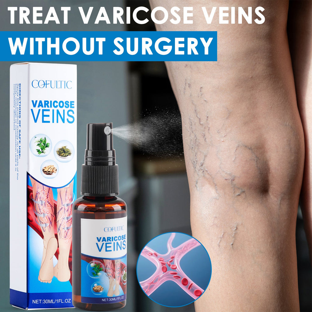 30ml Varicose Vein Spray Multi - Purpose Knee And Leg Care Spray Promote Blood Circulation - Beautybuzz