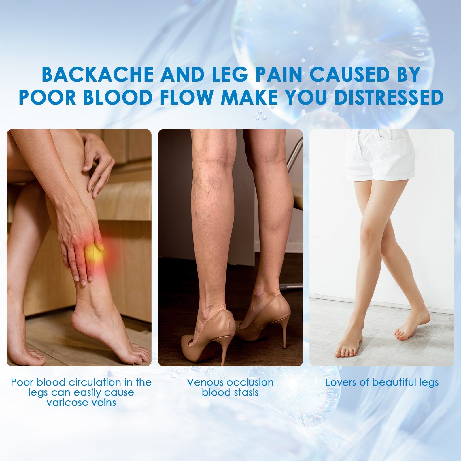 30ml Varicose Vein Spray Multi - Purpose Knee And Leg Care Spray Promote Blood Circulation - Beautybuzz