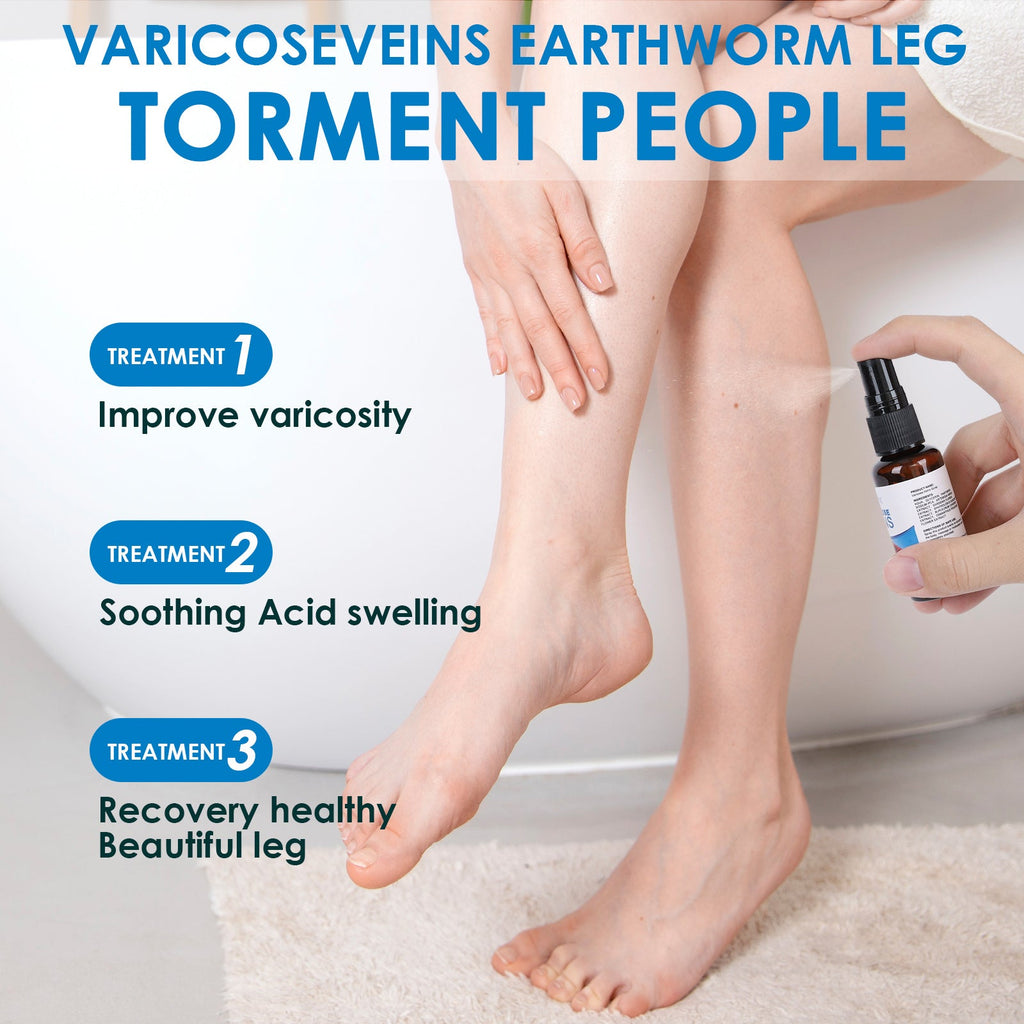 30ml Varicose Vein Spray Multi - Purpose Knee And Leg Care Spray Promote Blood Circulation - Beautybuzz
